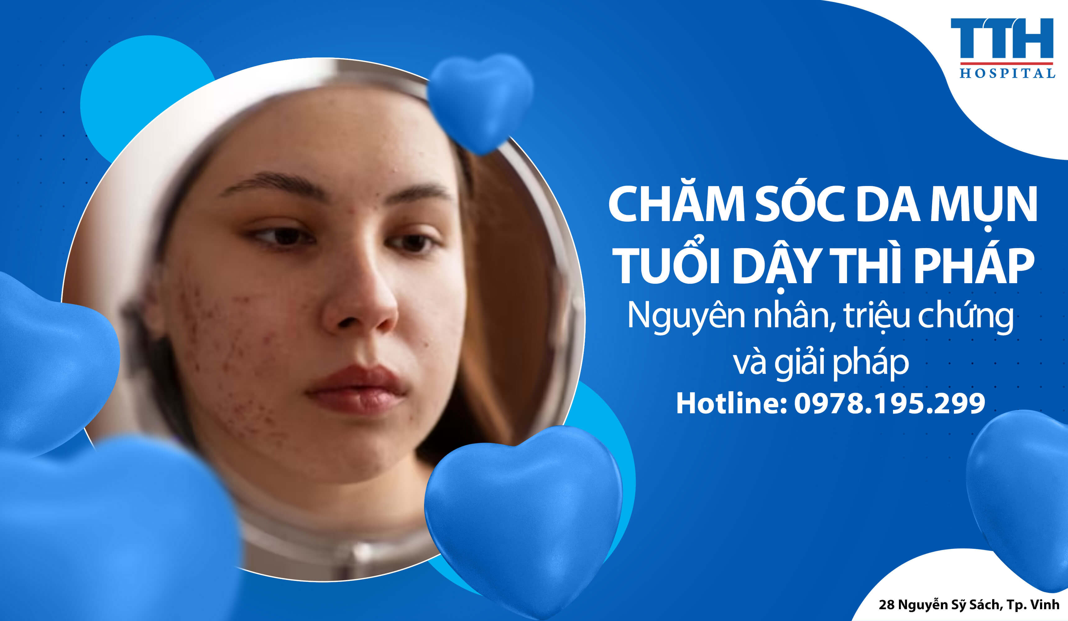 Chăm sóc da mụn tuổi dậy thì: Nguyên nhân, triệu chứng và giải pháp