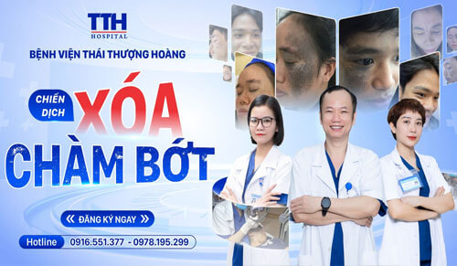 CHIẾN DỊCH XÓA CHÀM BỚT MIỄN PHÍ - CƠ HỘI VÀNG ĐÃ ĐẾN!