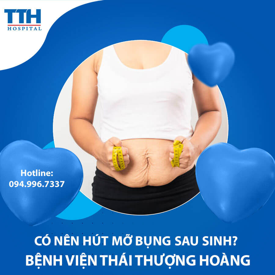 Có nên hút mỡ bụng sau sinh? Hút mỡ bụng uy tín tại Nghệ An, Hà Tĩnh