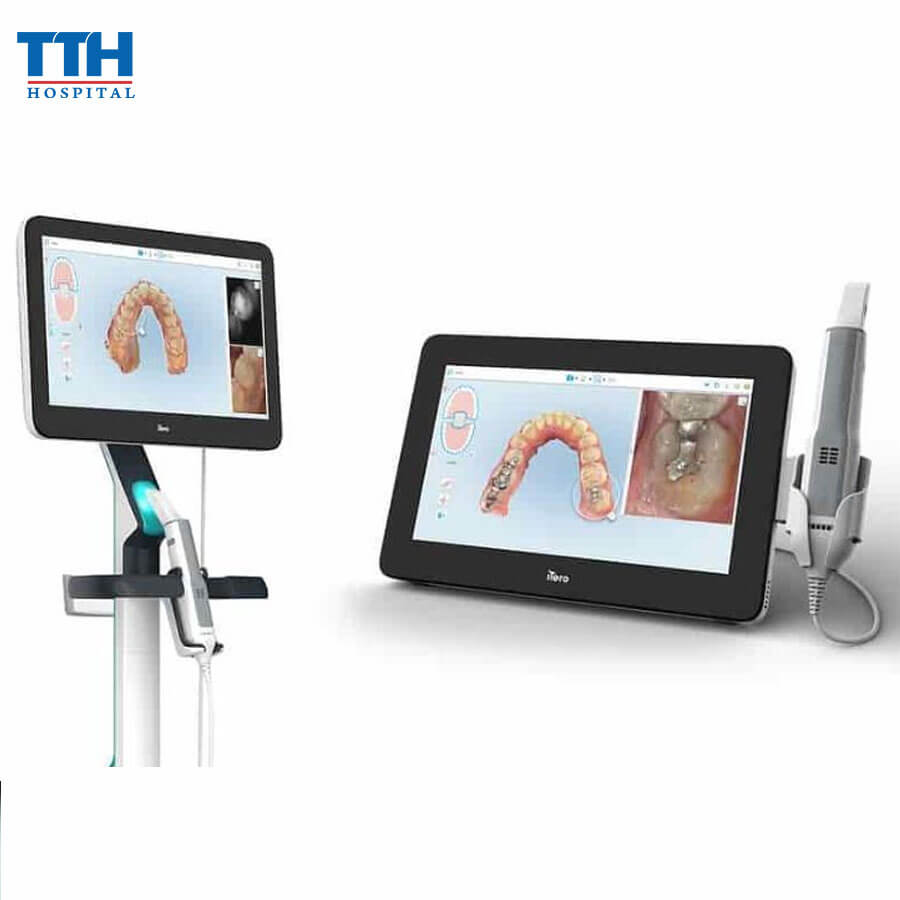 Công Nghệ Quét Dấu Răng ITERO 5D Tại Bệnh Viện Thái Thượng Hoàng