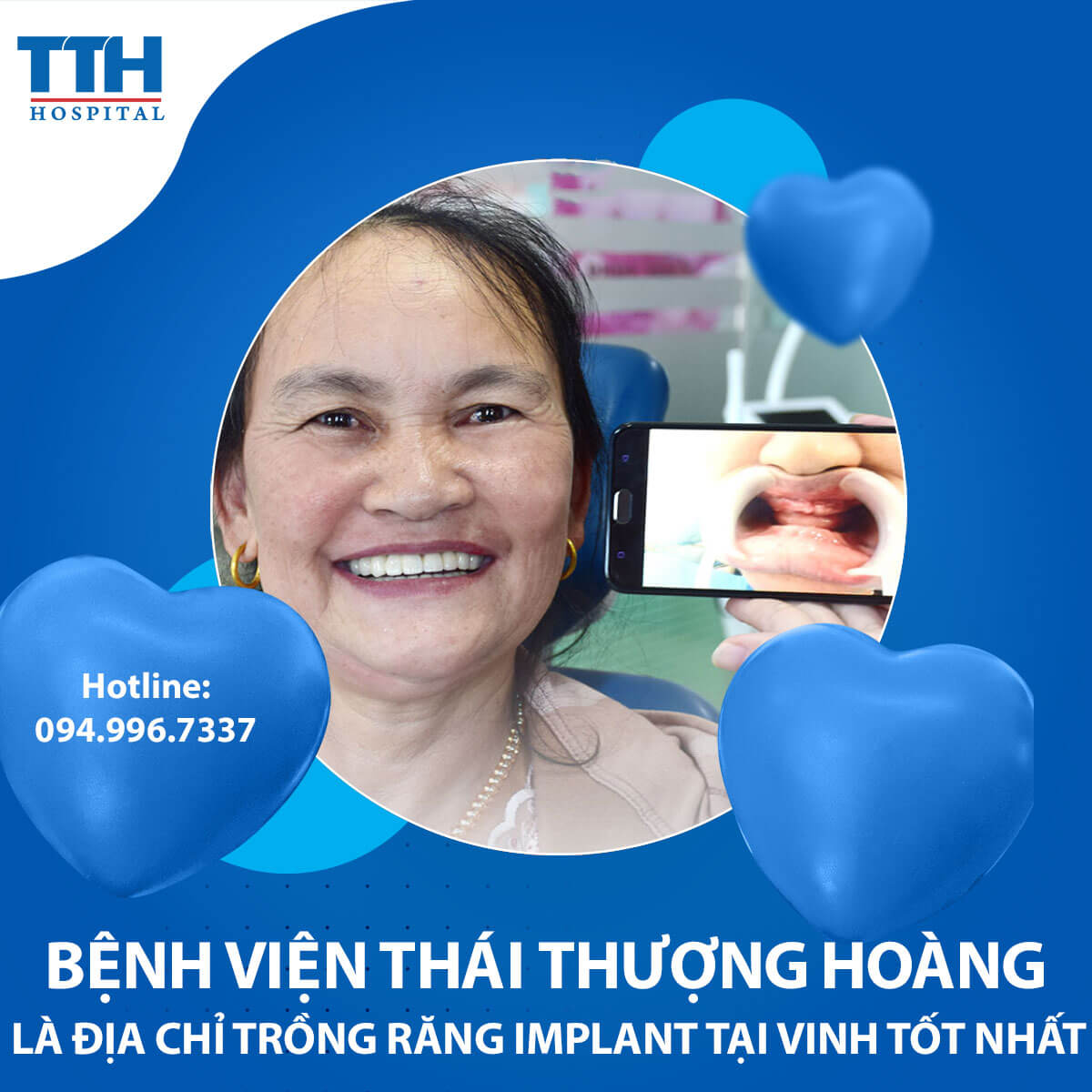 Địa chỉ Trồng Răng Implant tại Vinh, Nghệ An