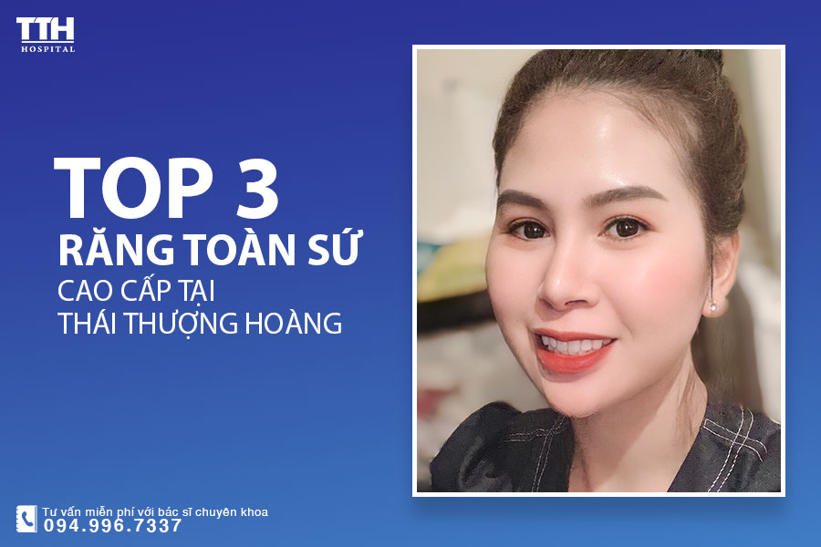 TOP 3 LOẠI RĂNG TOÀN SỨ THẨM MỸ PHỔ BIẾN