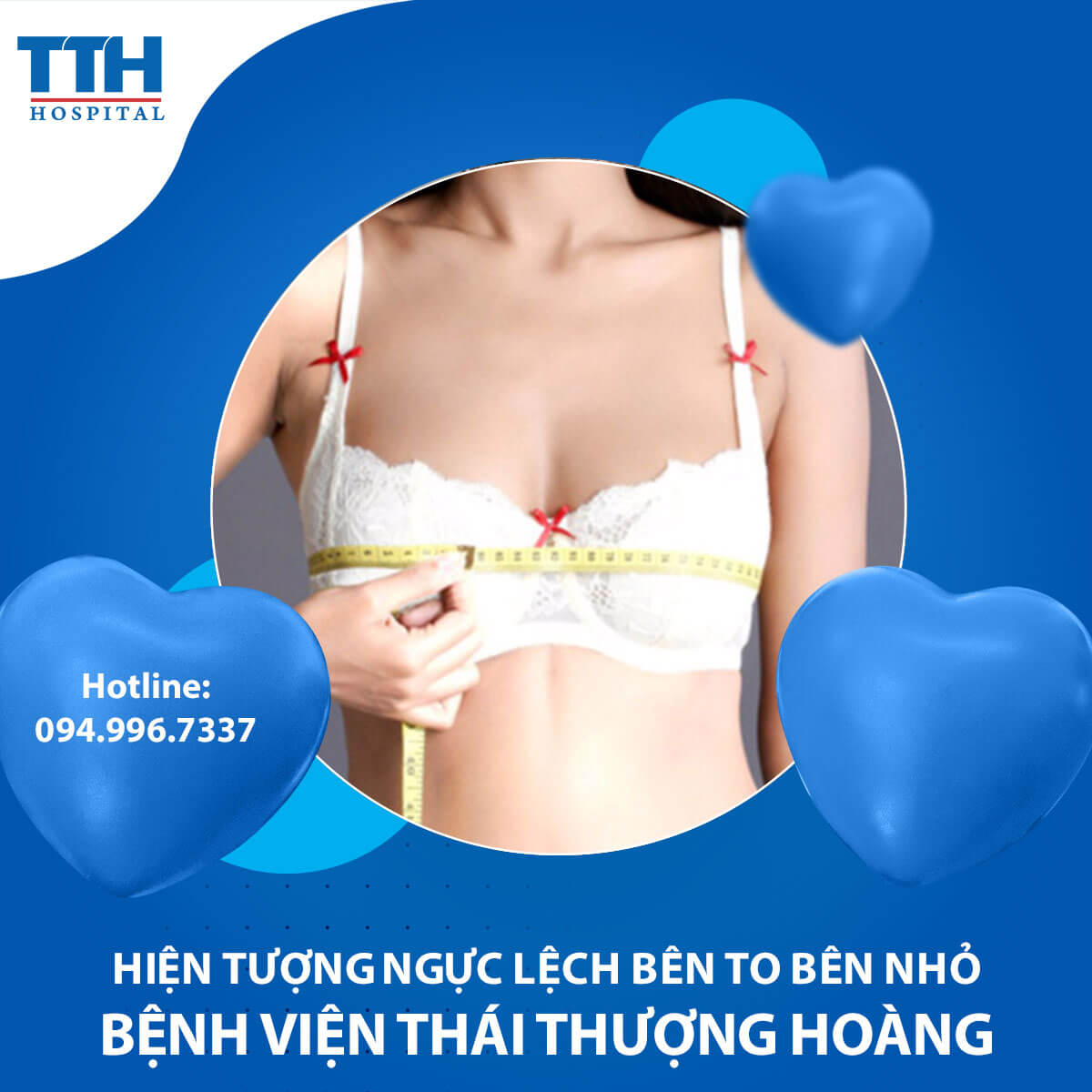 Hiện Tượng Ngực Lệch Bên To Bên Nhỏ: Nguyên Nhân và Cách Khắc Phục