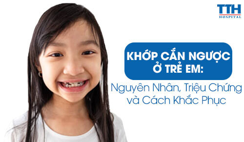 Khớp Cắn Ngược ở Trẻ Em: Nguyên Nhân, Triệu Chứng và Cách Khắc Phục