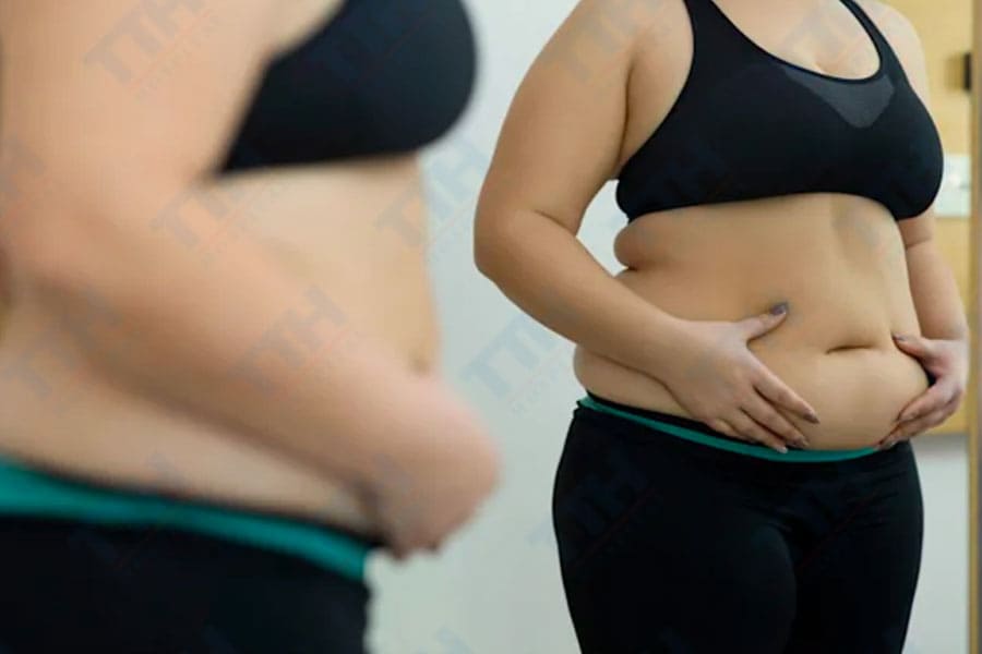 LOẠI BỎ “ĐỐNG” MỠ THỪA SAU TẾT - BẠN CHỌN HÚT MỠ HAY TẬP THỂ DỤC?