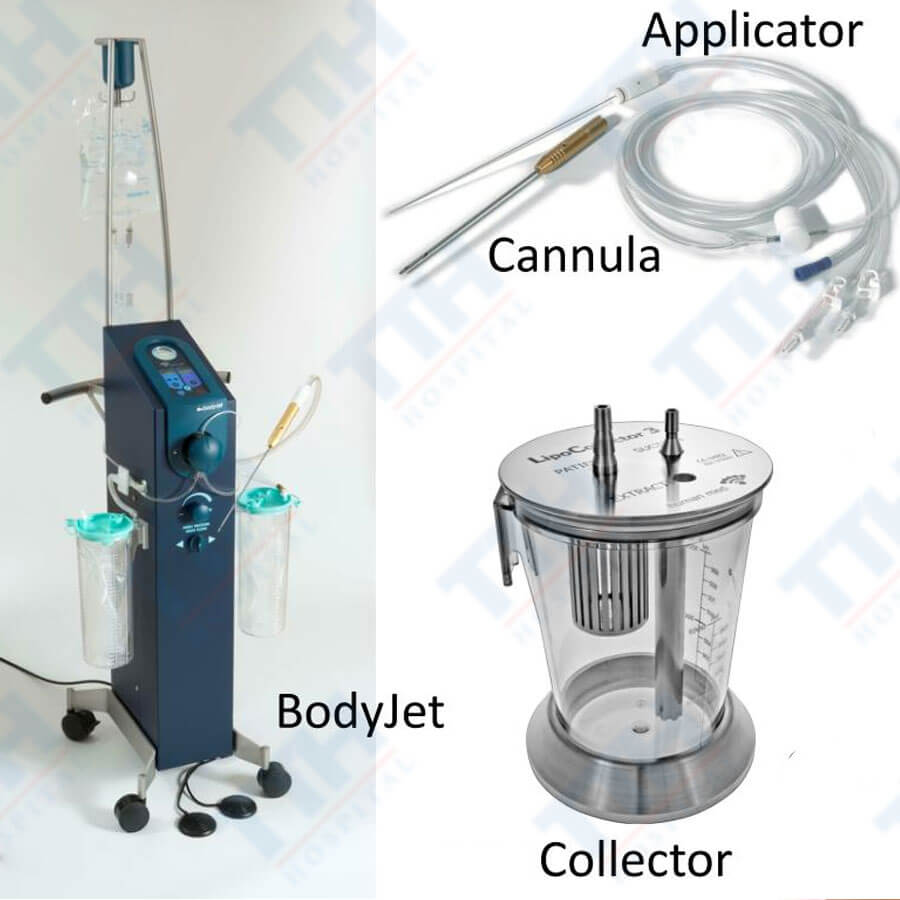 Lợi Ích Của Hút Mỡ Body Jet So Với Các Phương Pháp Truyền Thống