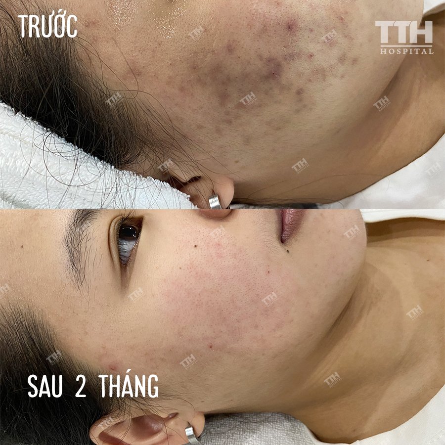 Thẩm mỹ nội khoa