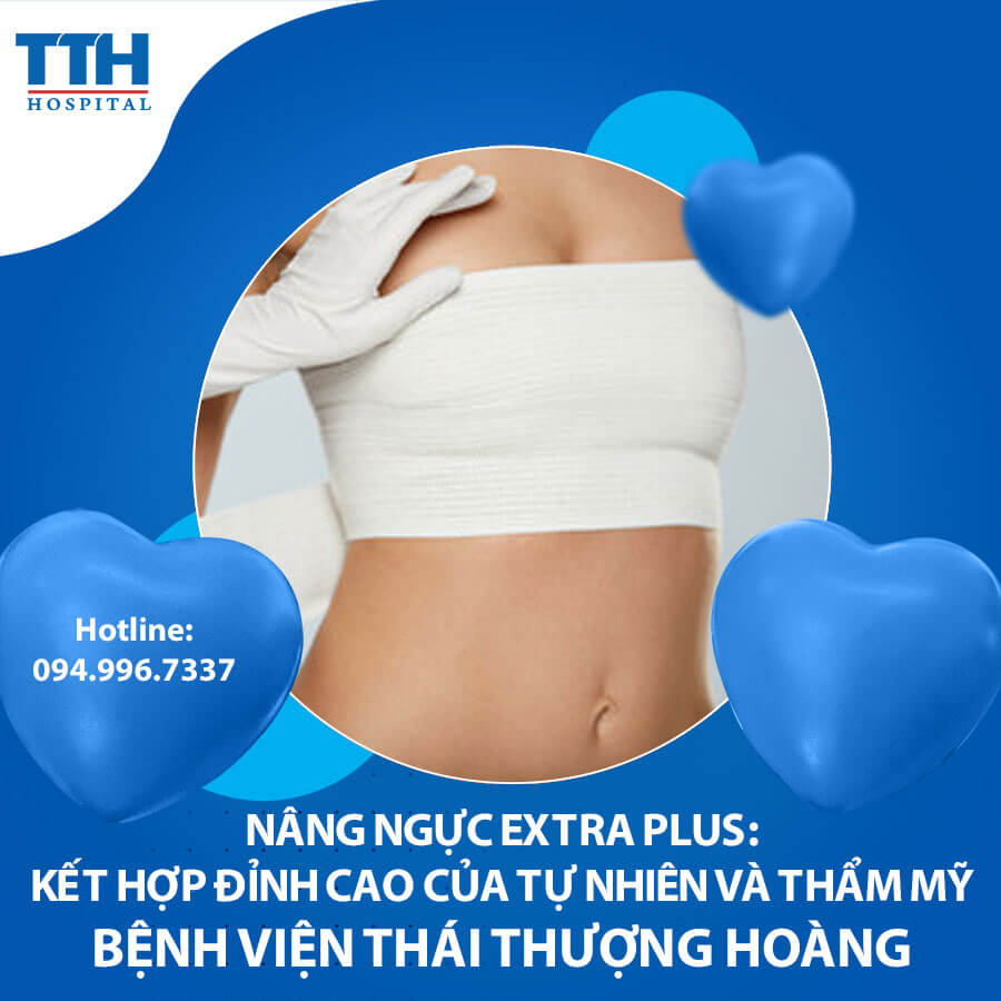Nâng ngực Extra Plus: Kết hợp đỉnh cao của tự nhiên và thẩm mỹ