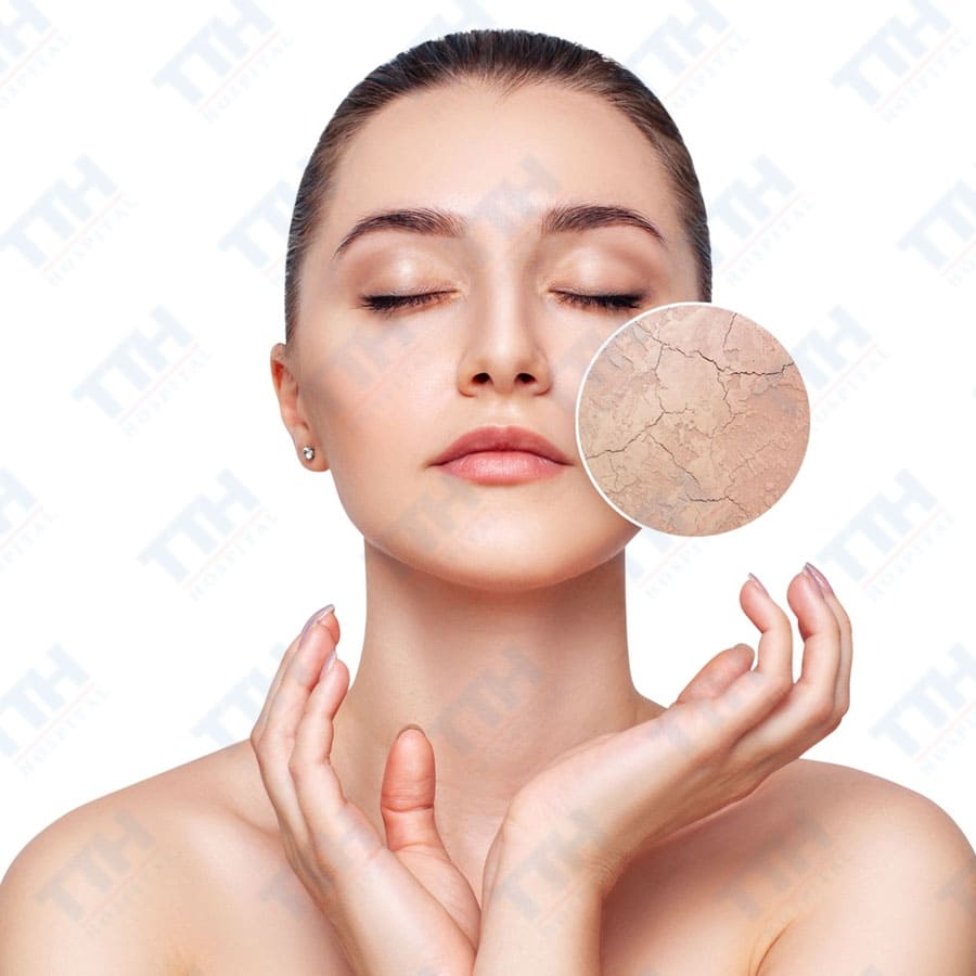 Nguyên Nhân Khiến Da Khô Ráp Trước Tết - Hiểu Rõ Để Chăm Sóc Hiệu Quả