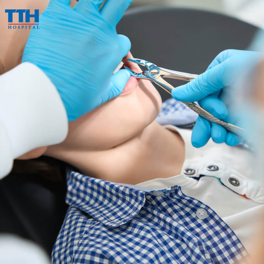 Nhổ Răng, Hàn Răng Tại Bệnh Viện Thái Thượng Hoàng: Chất Lượng, An Toàn Và Hiệu Quả