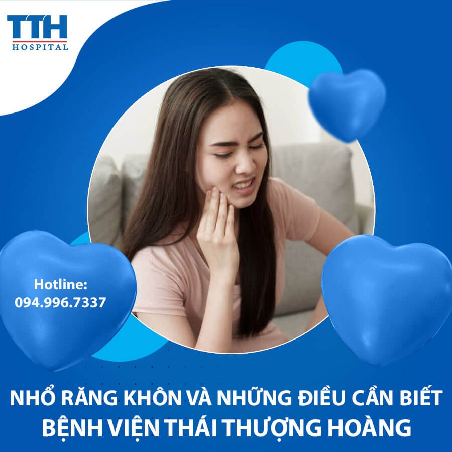 Nhổ Răng Khôn và những Điều Cần Biết