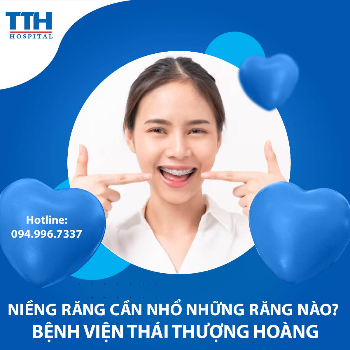 Niềng răng cần nhổ những răng nào? Chuyên gia giải đáp