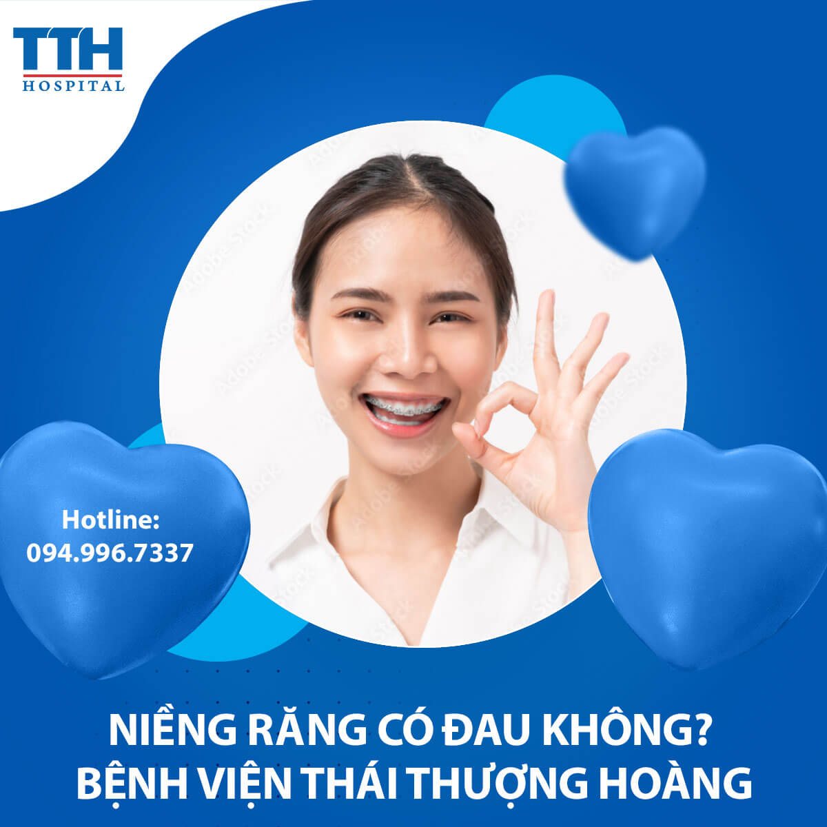 Niềng Răng Có Đau Không? Sự Thật Về Đau Khi Niềng Răng tại Vinh, Nghệ an