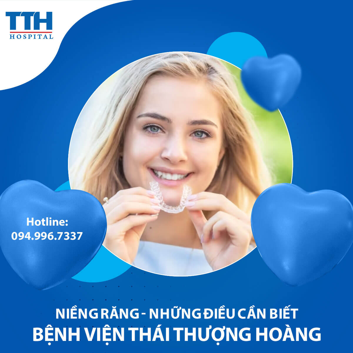 Niềng răng - Những điều cần biết