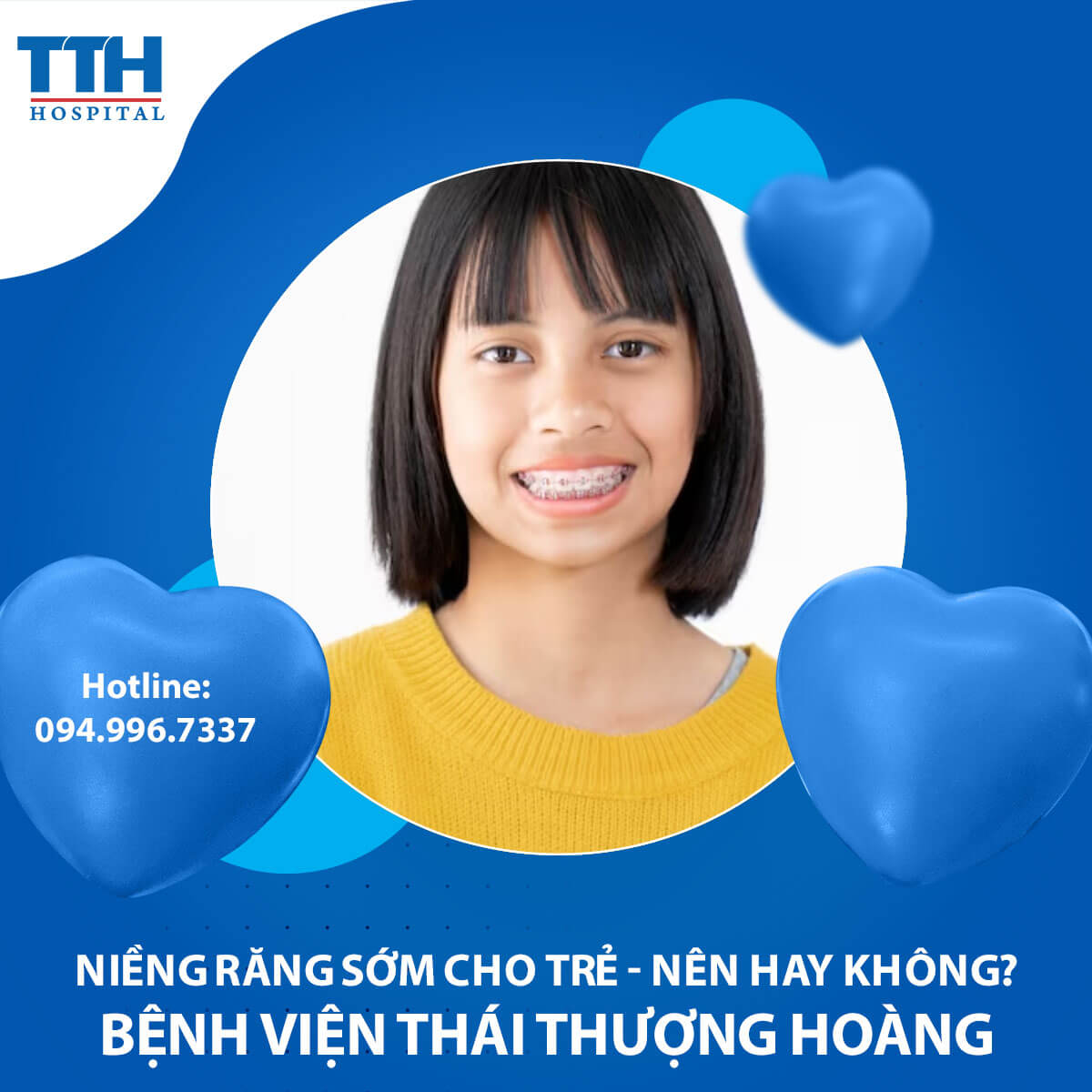 Niềng răng sớm cho trẻ - nên hay không?
