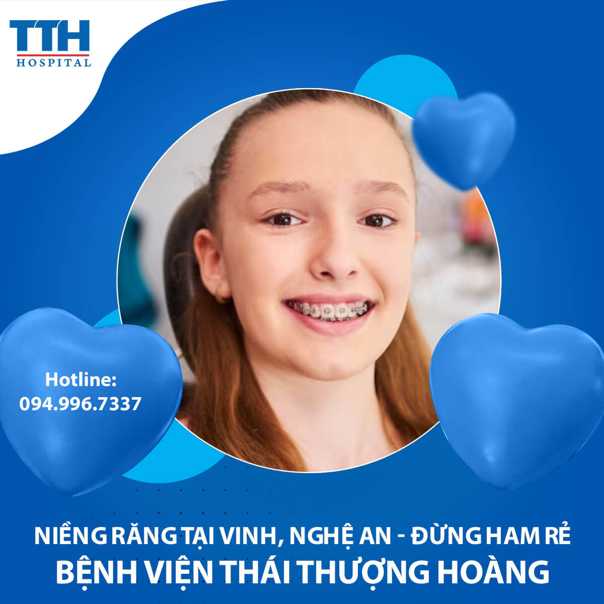 Niềng răng tại Vinh, Nghệ An - Đừng ham rẻ
