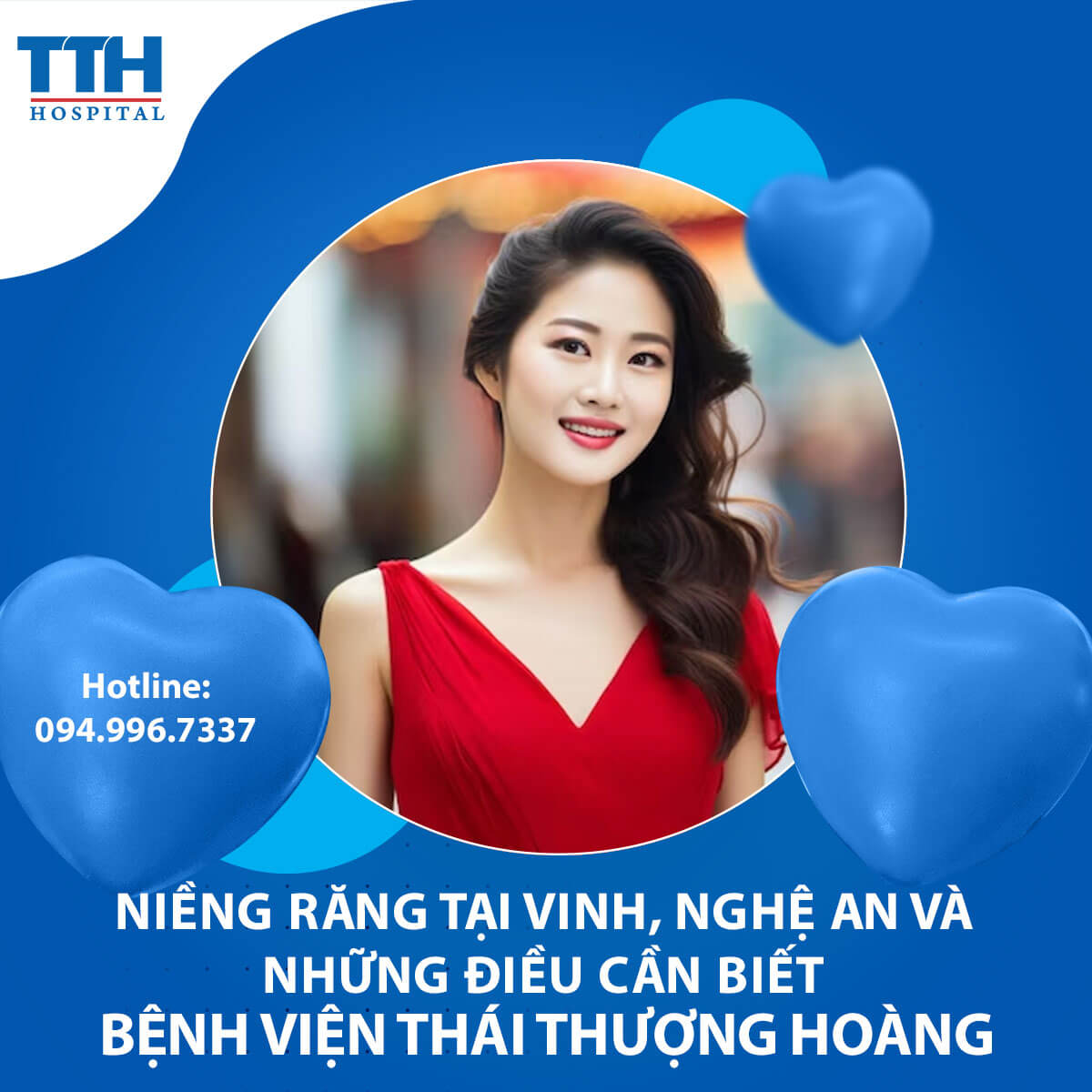 Niềng răng tại Vinh, Nghệ An và những điều cần biết