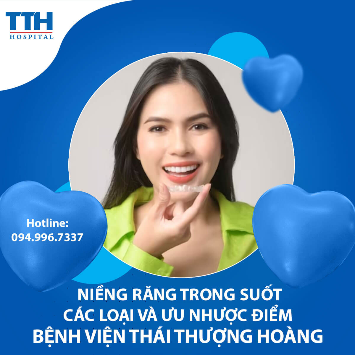 Niềng răng trong suốt có bao nhiêu loại?