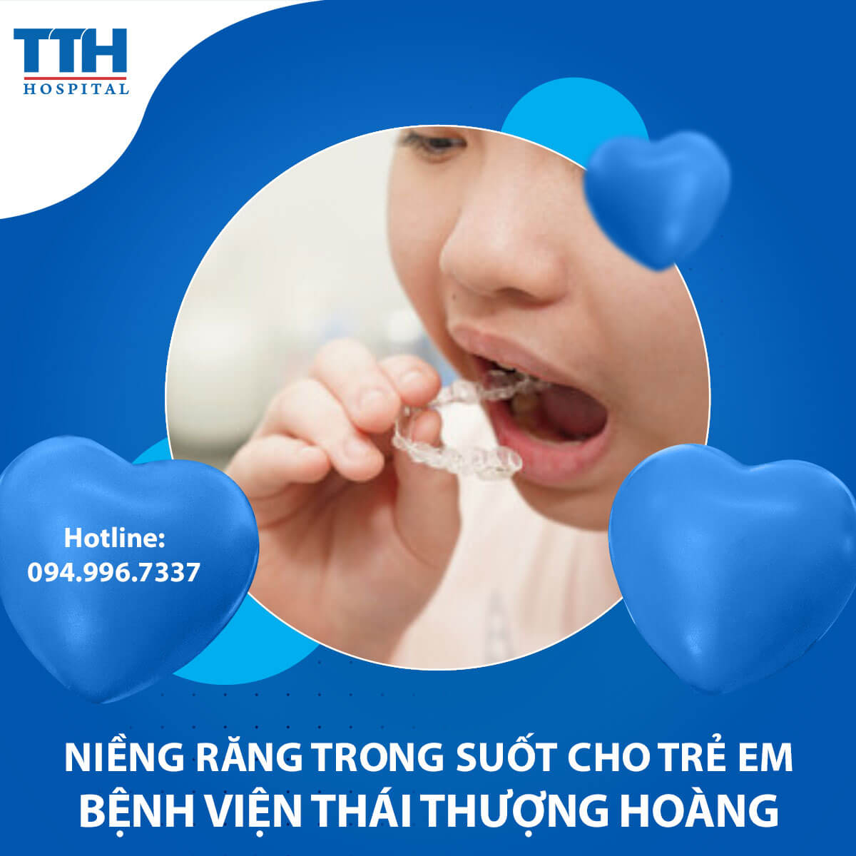 Niềng răng trong suốt cho trẻ em