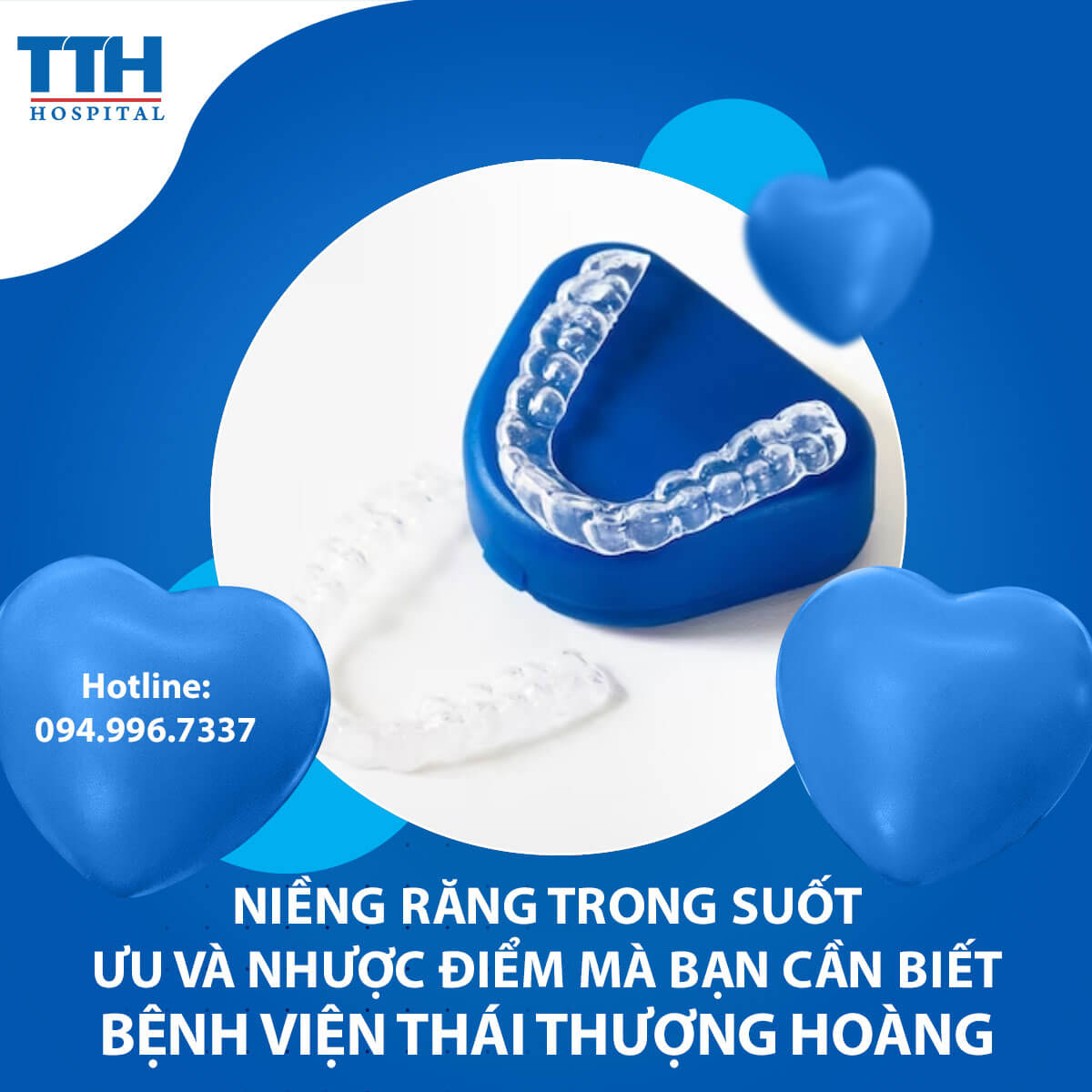 Niềng răng trong suốt - Ưu và nhược điểm mà bạn cần biết