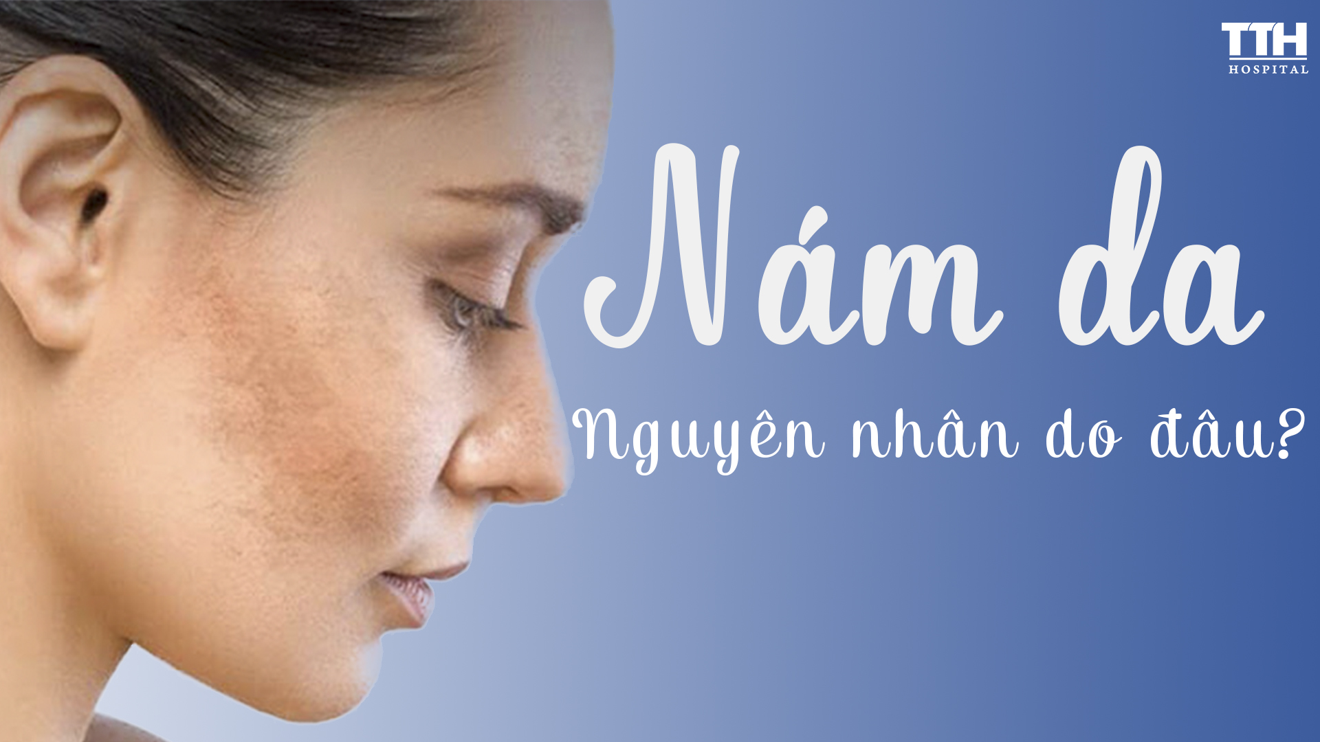 NÁM DA - NGUYÊN NHÂN DO ĐÂU?