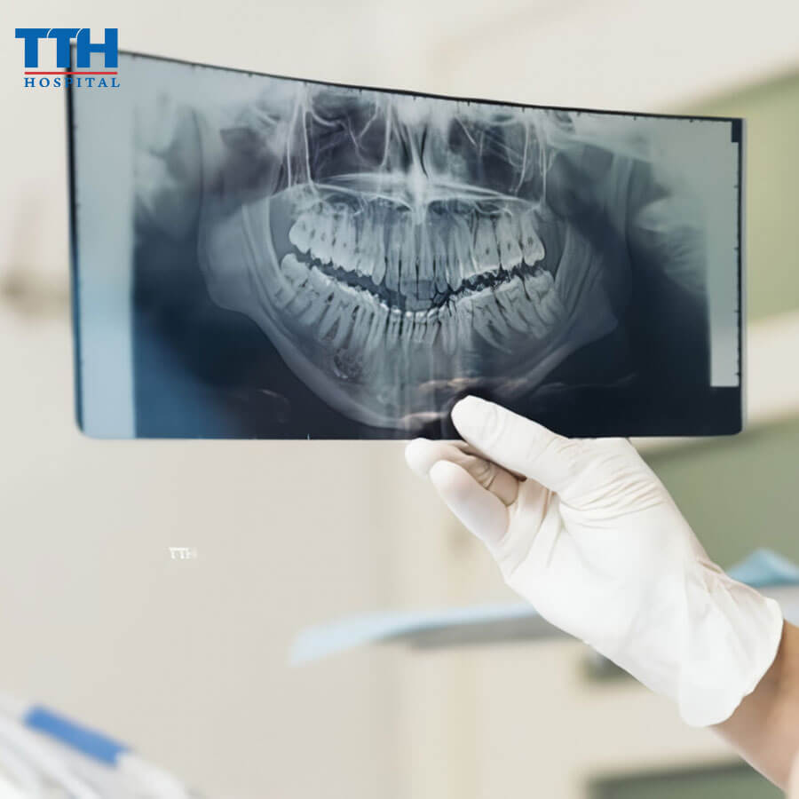 Phần Mềm Hỗ Trợ Niềng Răng VCEPH 3D: Bước Tiến Công Nghệ Trong Chỉnh Nha
