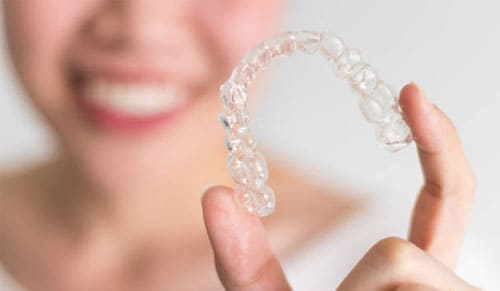 Quy trình thiết kế và sản xuất khay niềng răng trong suốt TTH Aligner: Từ công nghệ đến chất lượng