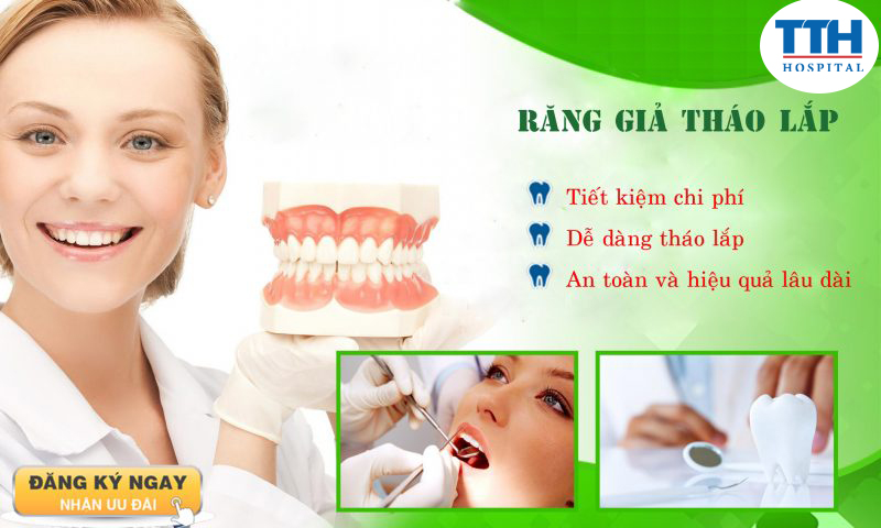 Răng Giả Tháo Lắp là Gì? Khi nào thì dùng phương pháp này