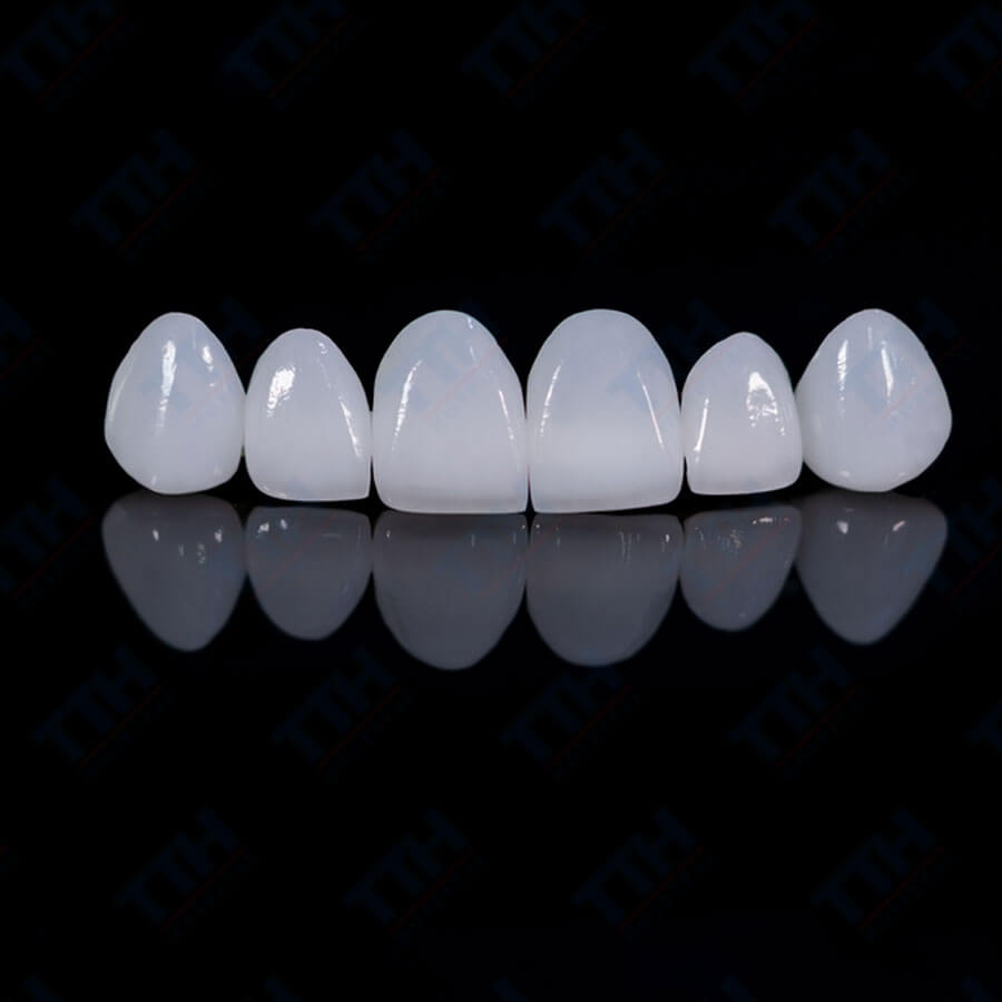 Răng Sứ Lava: Sự Lựa Chọn Hoàn Hảo Cho Nụ Cười Rạng Rỡ