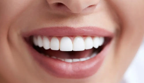Răng Sứ Zirconia Có Thực Sự An Toàn và Hiệu Quả Không?