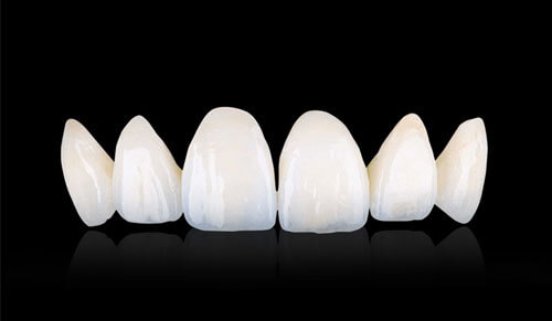Răng Sứ Zirconia: Ưu Điểm và Nhược Điểm Cần Biết Trước Khi Lựa Chọn