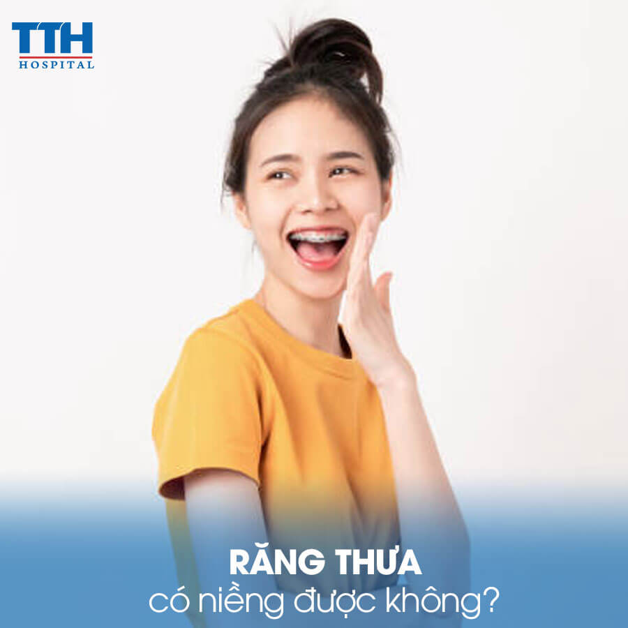 Răng thưa có niềng được không?