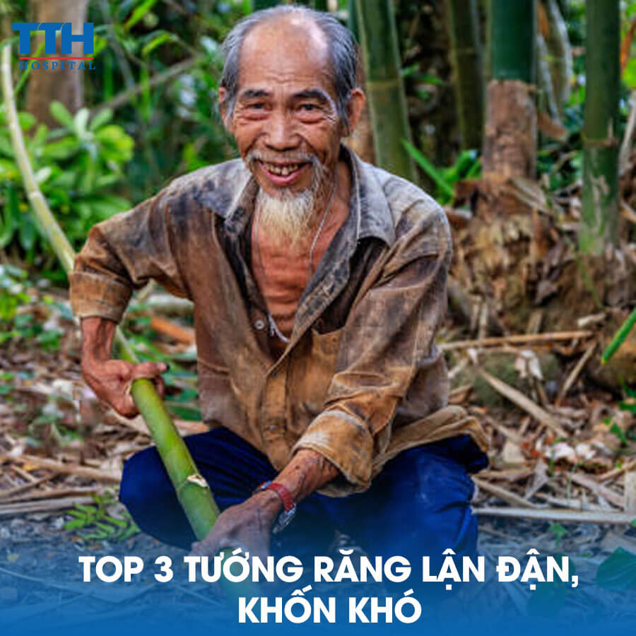 Top 3 Tướng Răng Lận Đận, Khốn Khó