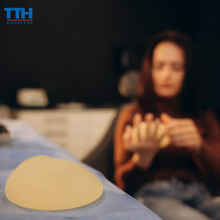 Túi ngực Mentor và những điều cần biết