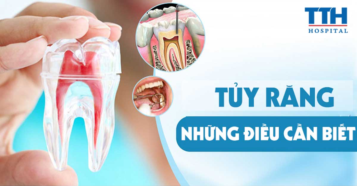 Tủy răng - Những điều cần biết