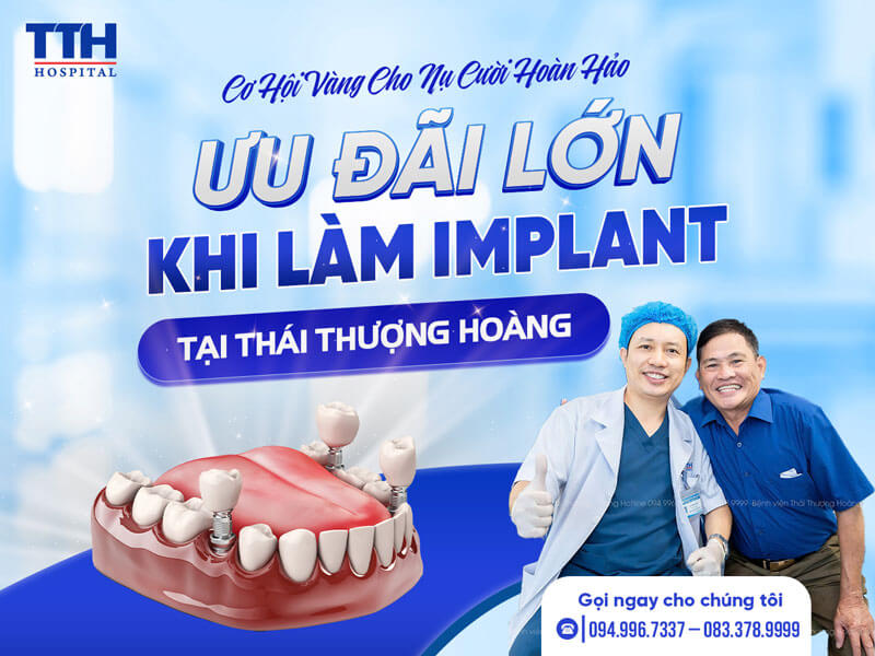 Ưu Đãi Lớn Khi Làm Implant Tại Bệnh Viện Thái Thượng Hoàng