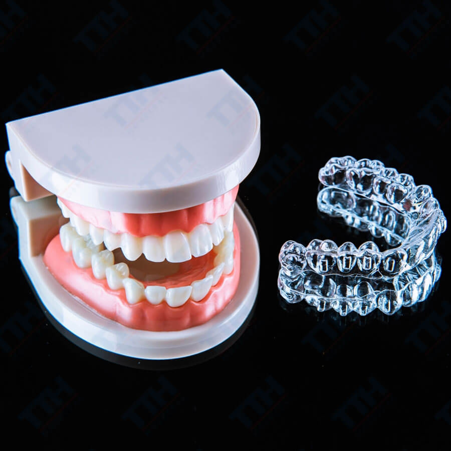 Ưu Điểm Của Chỉnh Nha Trong Suốt TTH Aligners So Với Niềng Răng Truyền Thống