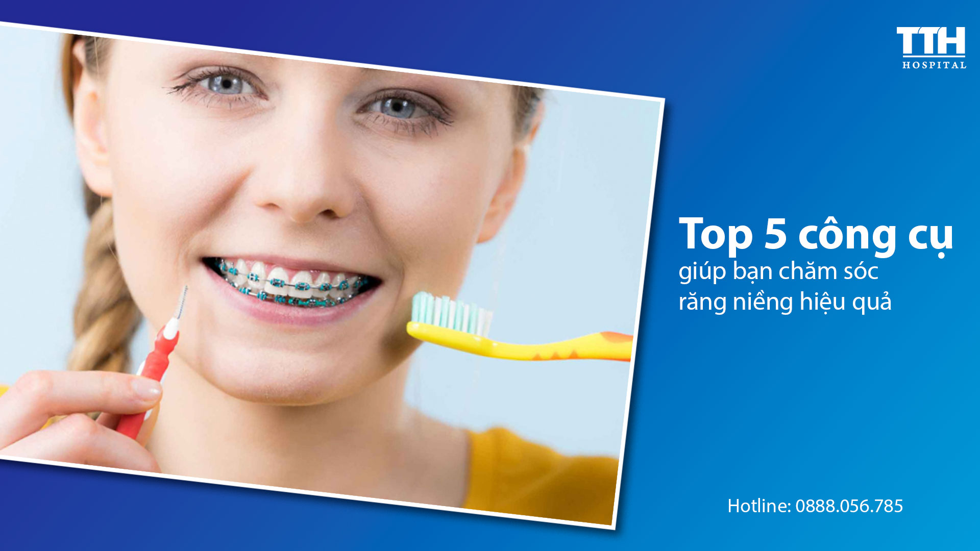 Top 5 công cụ giúp bạn chăm sóc răng niềng hiệu quả