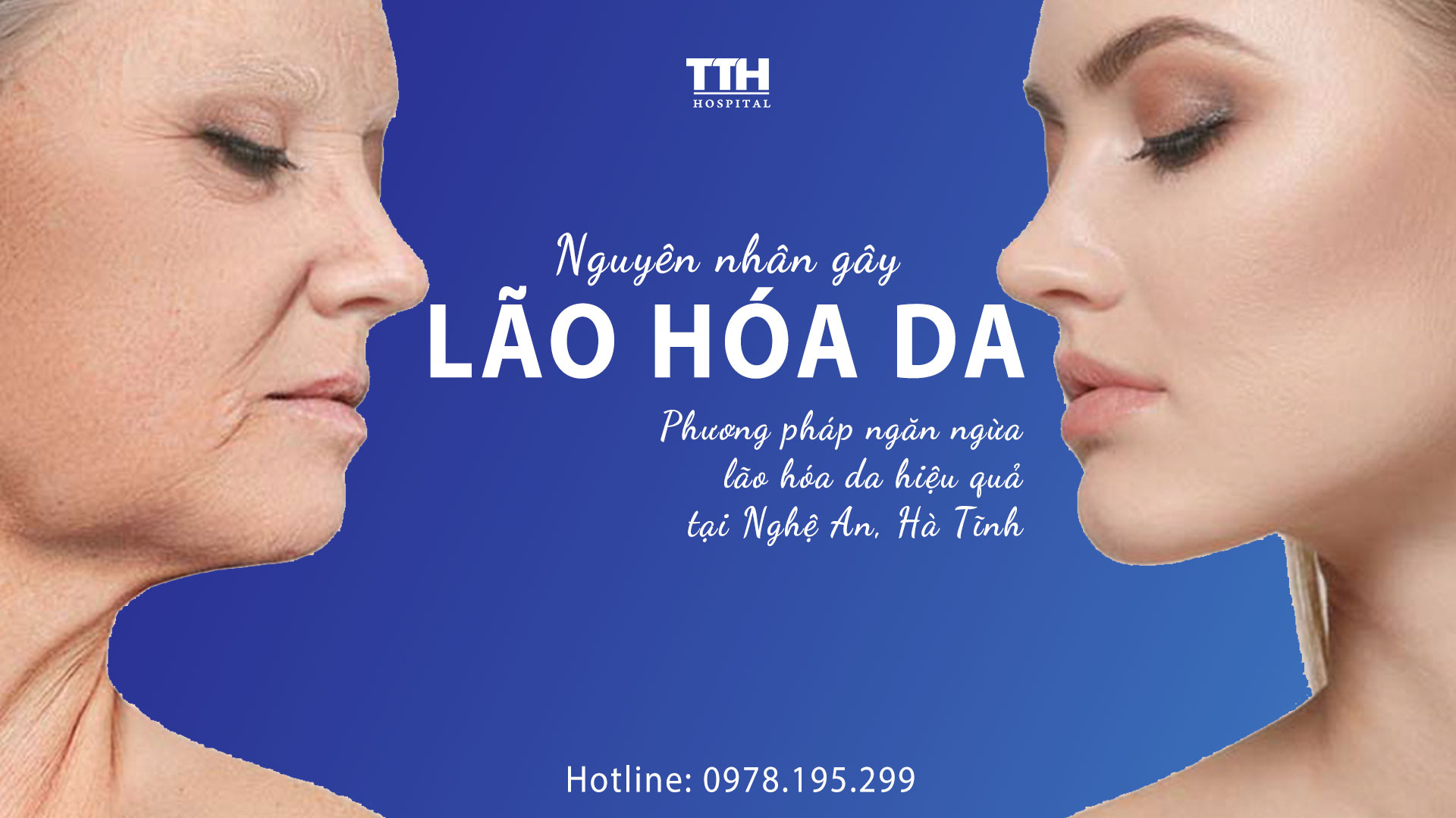 Nguyên nhân gây lão hóa da? Phương pháp ngăn ngừa lão hóa da hiệu quả tại Nghệ An, Hà Tĩnh