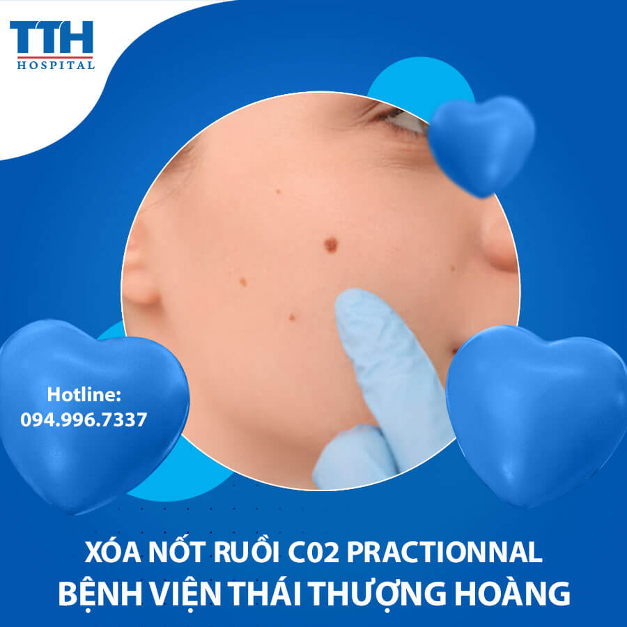 Xóa nốt ruồi C02 Practionnal